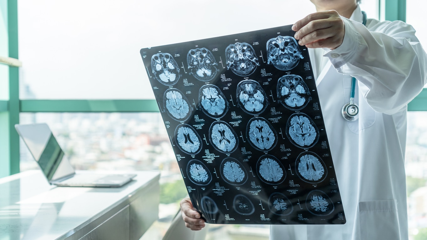nerve damage lawyer